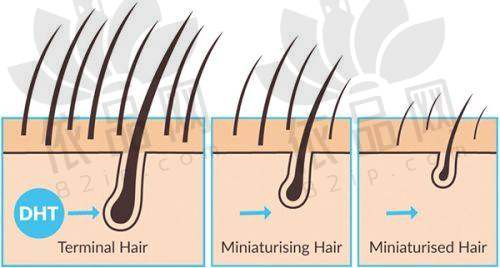 福州前十强微创植发医院详细介绍