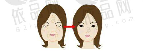 玻尿酸填充的魅力