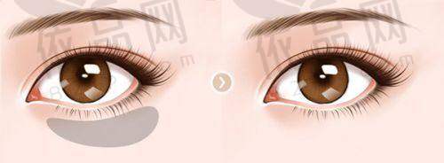 2、昆明延安医院整形科医生介绍