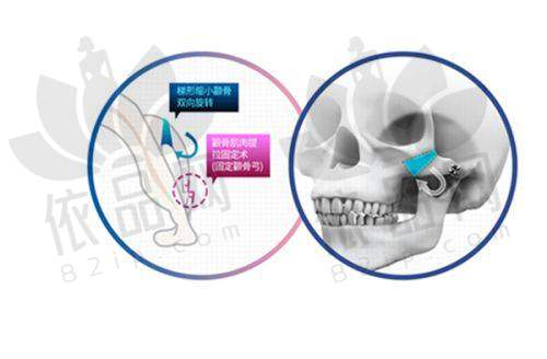 三、临床实证:数据与实例支撑成效