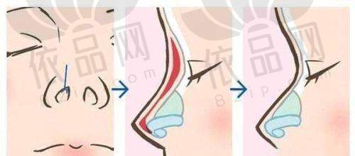 赵军舰医生的技术优势与独特之处